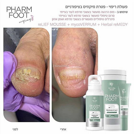 ��� ����� ����� ����� ���� ���� ������- reLIEF MOUSSE Pharm Foot