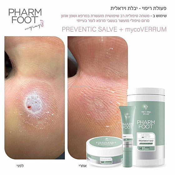 ���� ������� �� ������� ������ ����� ���� ���� �����- PREVENTIC SALVE | Pharm Foot